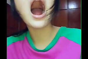 Asian Girl Showing her Teeth Cavities