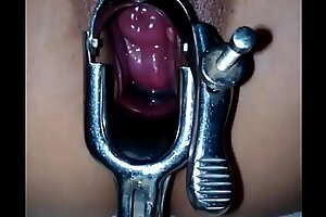 Cherry fisting pussy with speculum